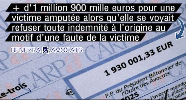 Exemple d'indemnisation d’une victime amputée de sa jambe