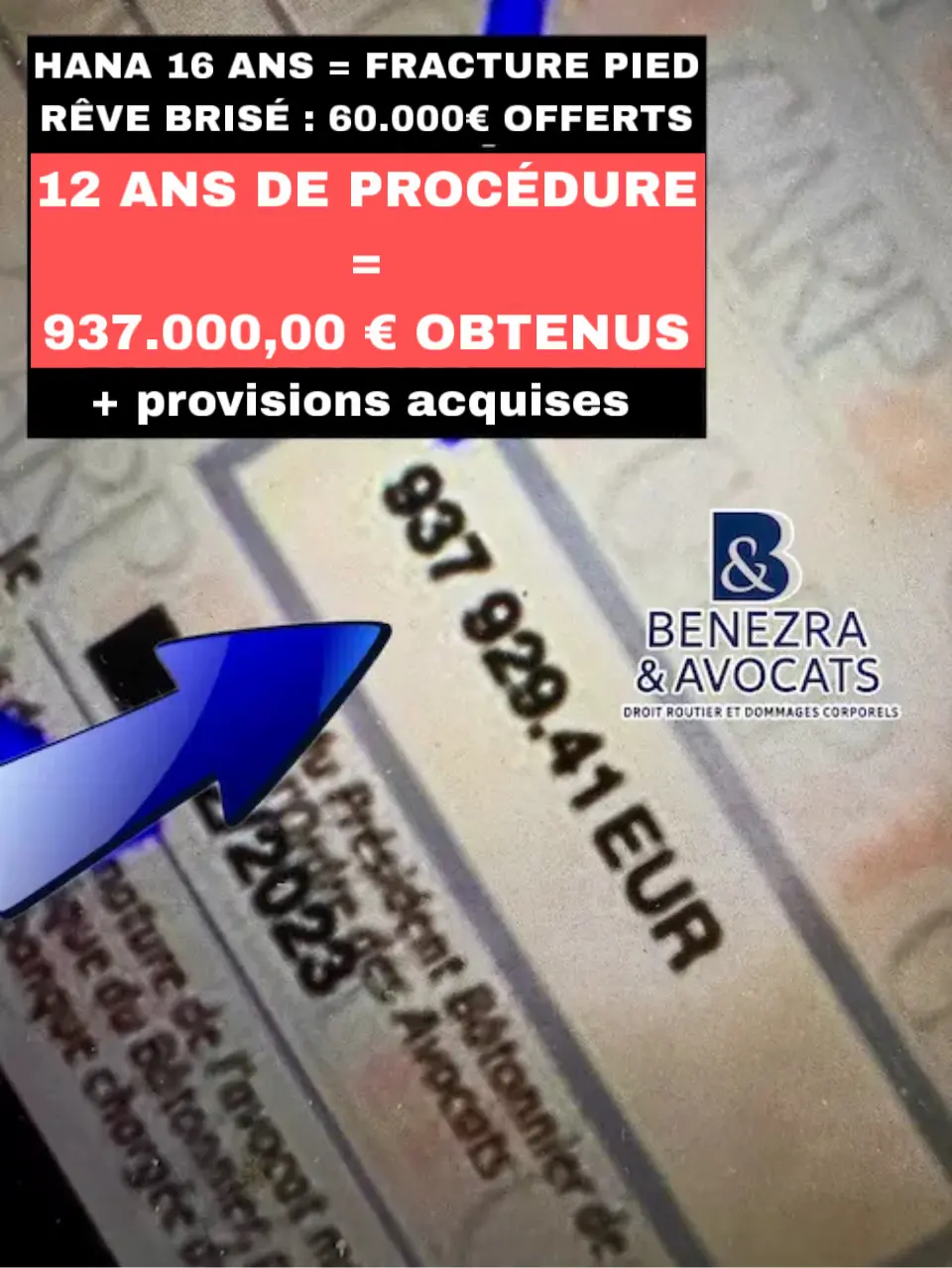 Exemple d'indemnisation pour une fracture chez la jeune victime